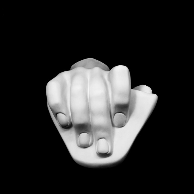 Plaster Cast The Wrist Of David