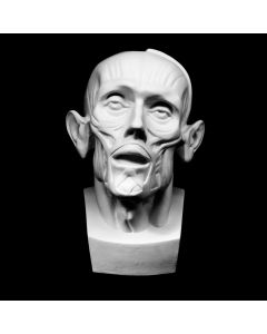 Plaster Cast The Munich Head